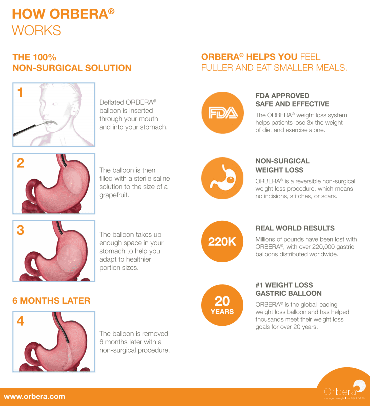 Orbera Gastric Balloon Jacksonville