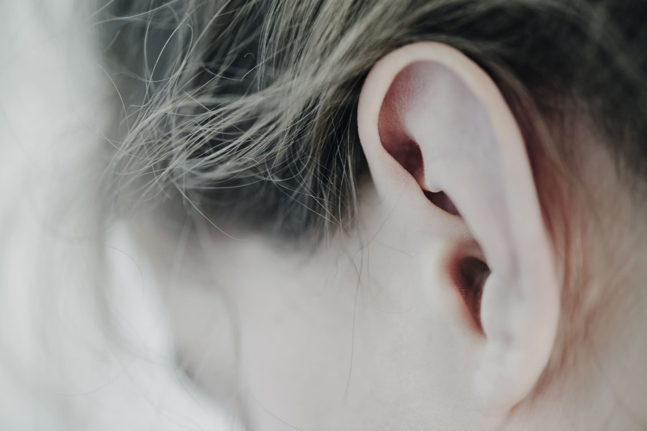 Close-Up of The Ear of a Young Girl. Otoplasty (Ear Surgery) in Jacksonville, FL